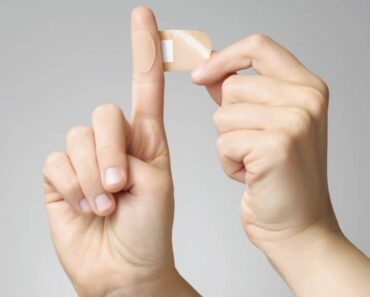 Como Quitar Las Verrugas: 9 Trucos Infalibles